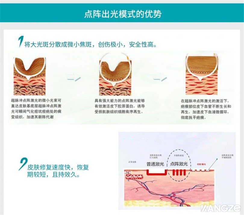 点阵模式优势