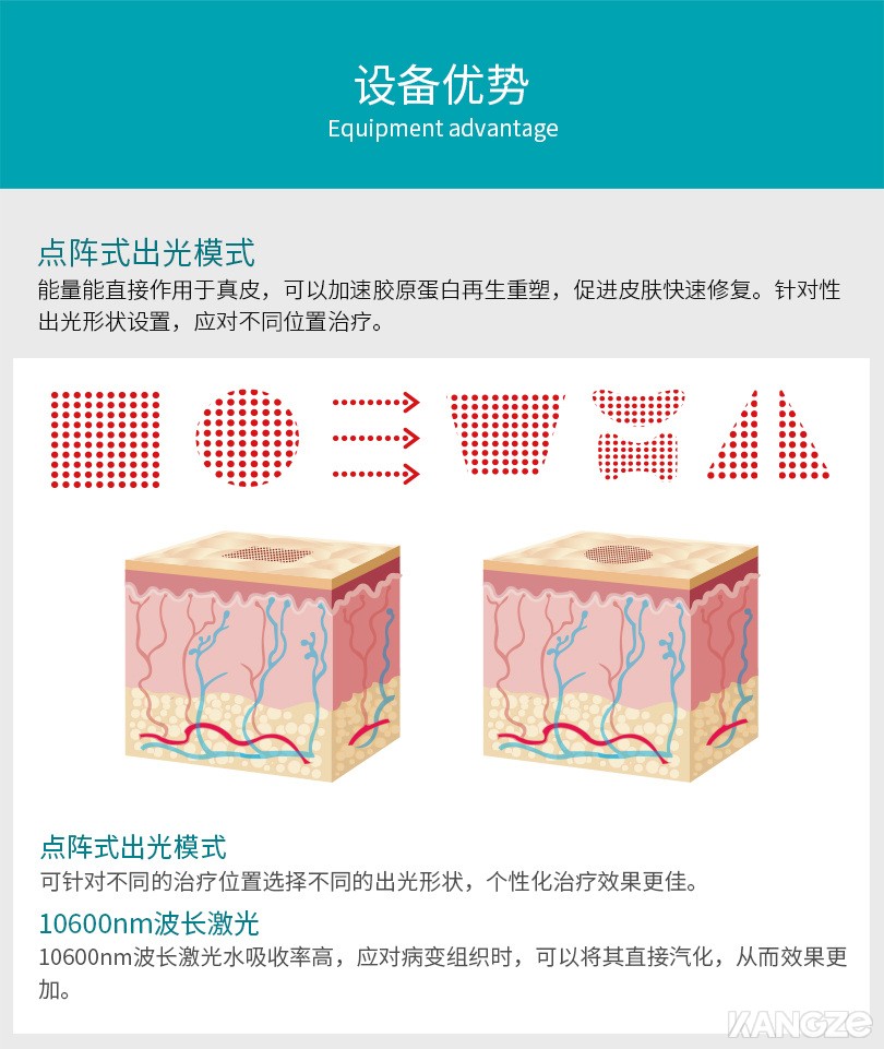 Queen 二氧化碳点阵激光治疗仪设备优势