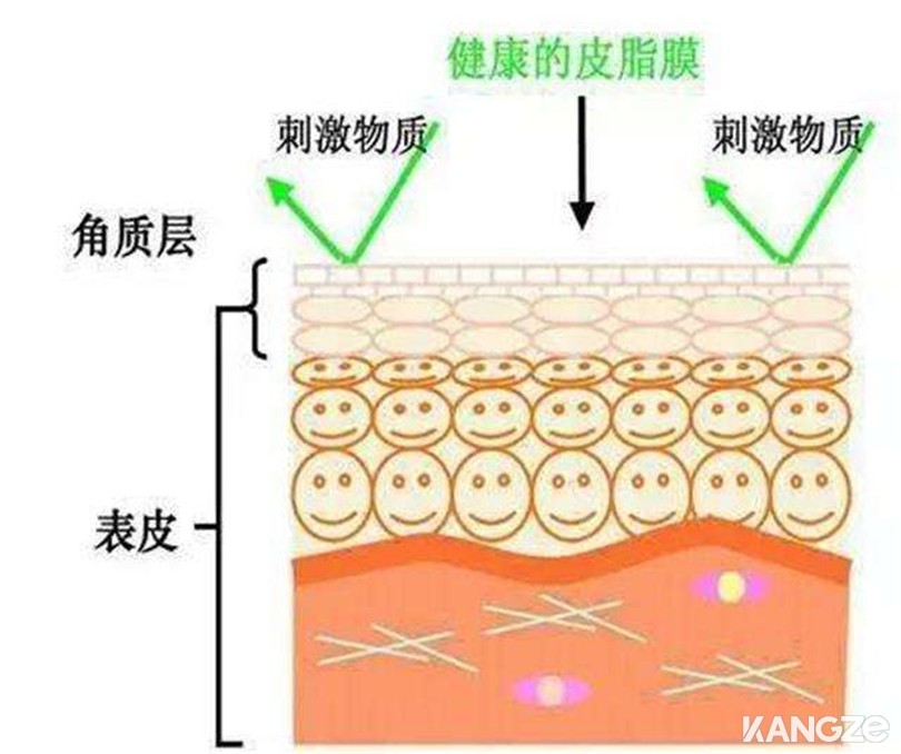 外部预防