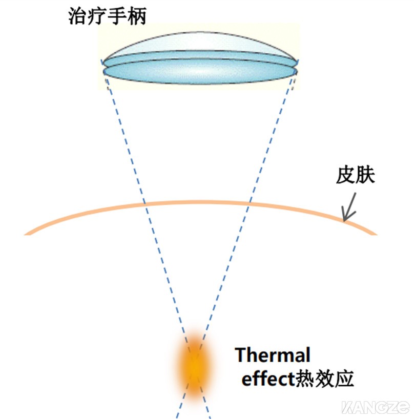 超声刀治疗原理