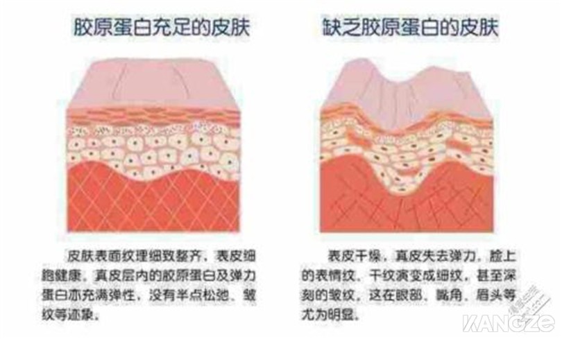 选择性光热效应刺激胶原